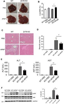 ZnT8 Deficiency Protects From APAP-Induced Acute Liver Injury by Reducing Oxidative Stress Through Upregulating Hepatic Zinc and Metallothioneins